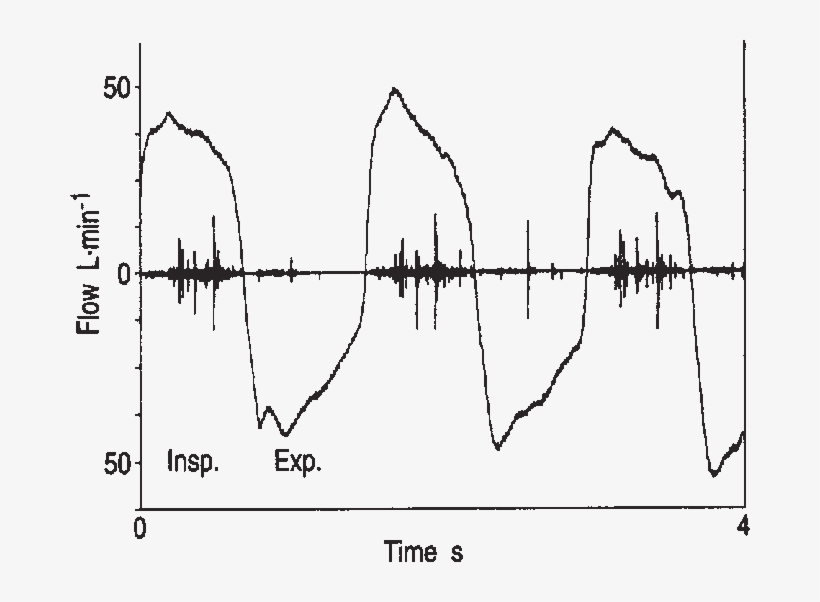 Signals) Of The Breath Sounds Of A Patient With Fibrosing - Respiratory Sounds, transparent png download