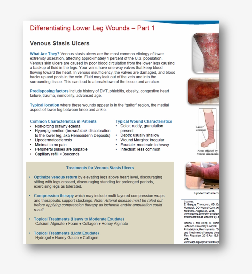 Talon Talon - Sketch, transparent png download