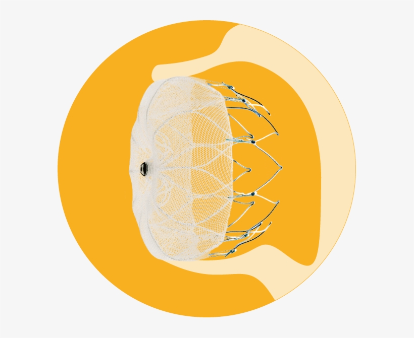 People With Af Have 5x Greater Risk Of Stroke, transparent png download