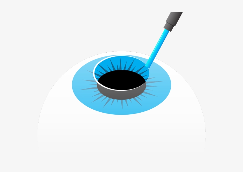 The Disturbed Epithelial Cells Start Regenerating Immediately, transparent png download