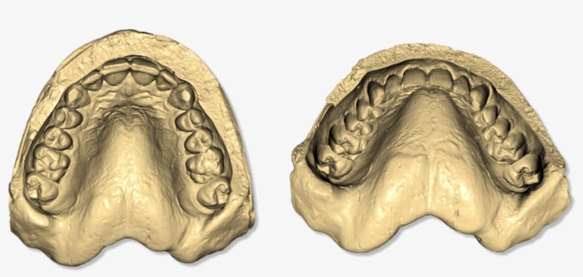 File - Maestro3d - Easy - Dental - Scan - Taget - Object, transparent png download