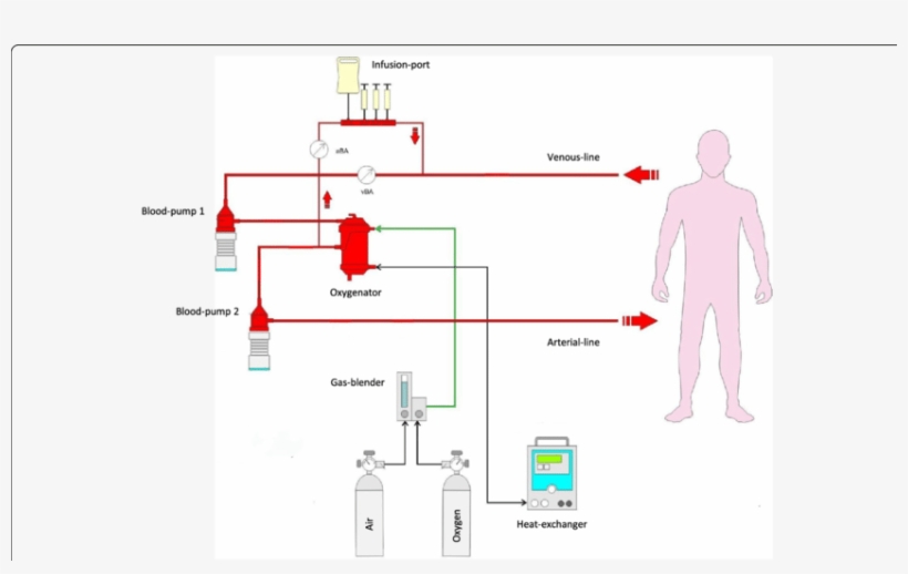 Schematic Outline Of The Controlled Integrated Resuscitation, transparent png download