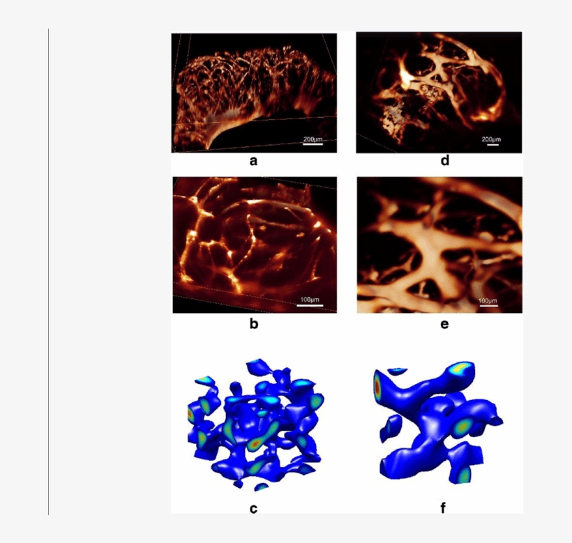 Alterations Of The 3d Self-organized Vmc Multicellular, transparent png download