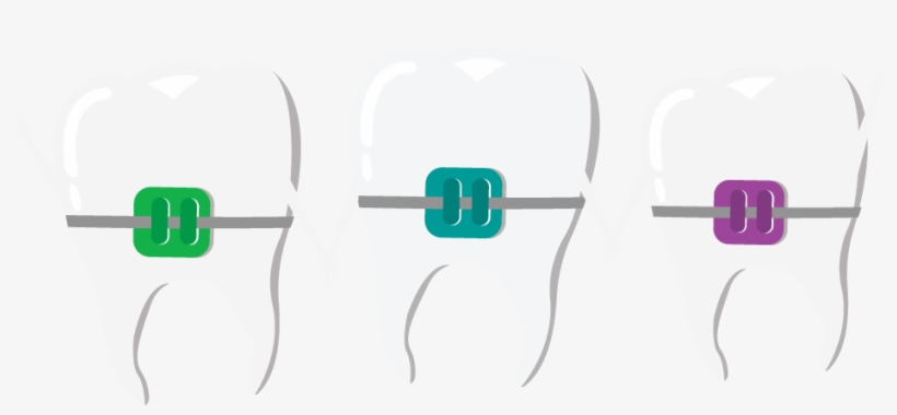 Colored-braces, transparent png download