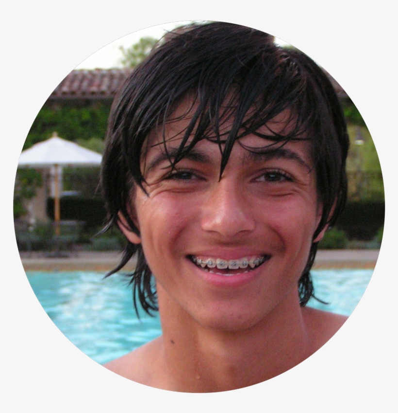 Metal Braces Are The Least Expensive Type Of Braces, transparent png download