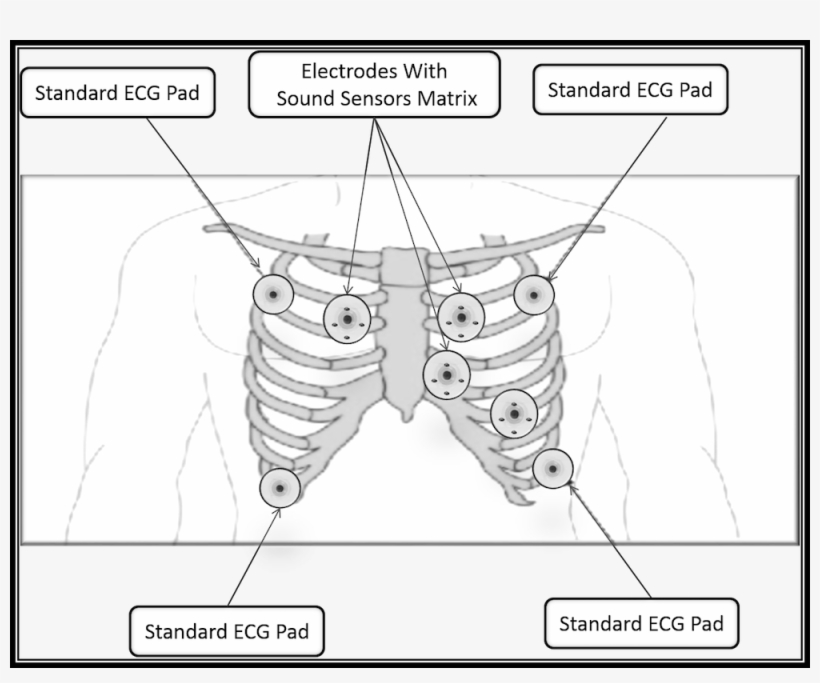 Cardiovascular Disease Is The Leading Cause Of Death - Cartoon, transparent png download