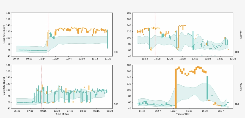 Arrhythmia Activity Bars - Heart Arrhythmia, transparent png download