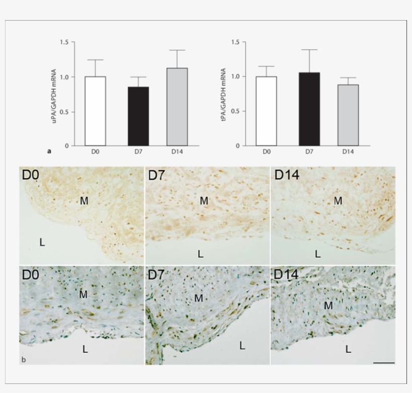 Upa And Tpa Regulation In Human Veins Submitted To - Human, transparent png download