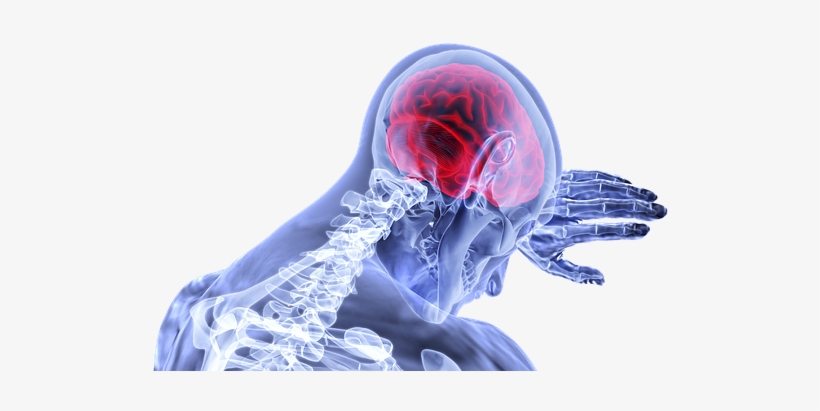 Brain, Inflammation, Stroke, Medical - Brain, transparent png download