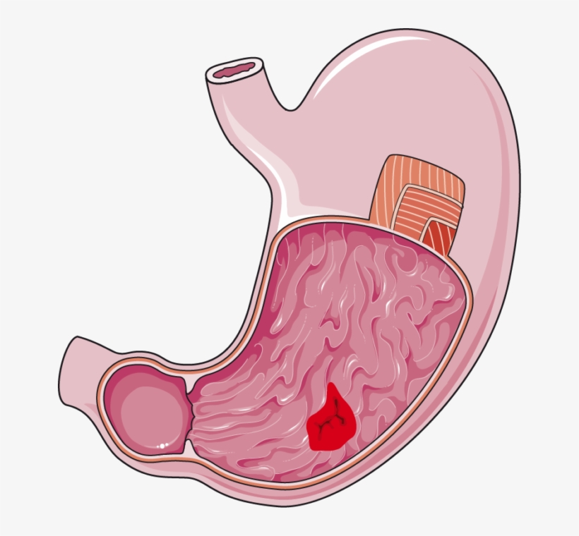 Stomach Clipart Transparent Clipart Black And White - Stomach Clipart Png, transparent png download
