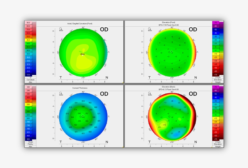 4 Maps Refactive Of The Stable Right Eye, transparent png download