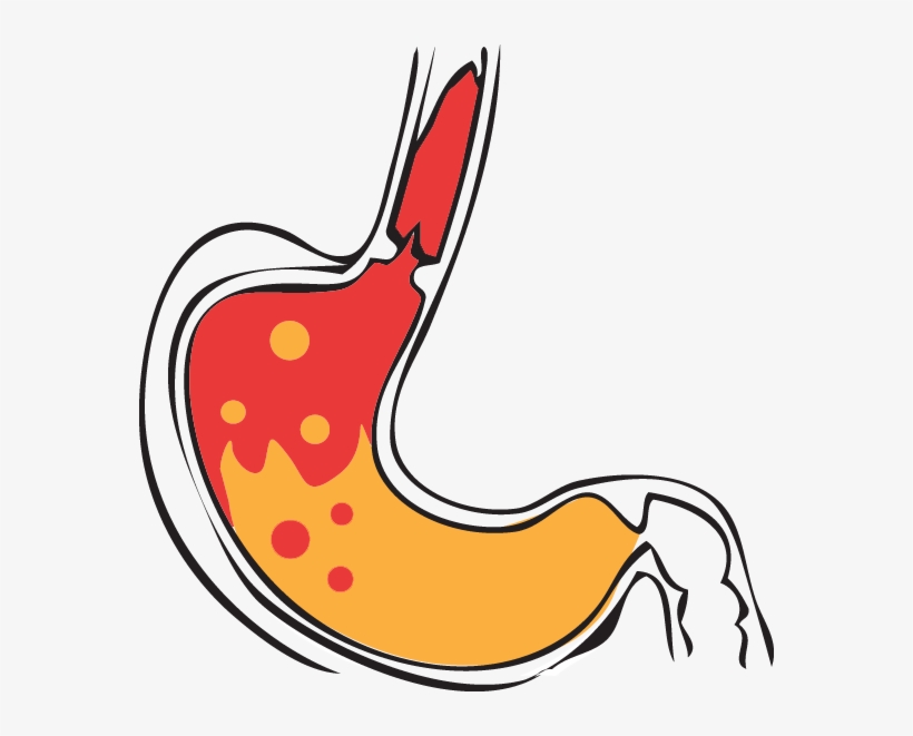 Stomach Acid Transparent - Stomach Acid Png, transparent png download