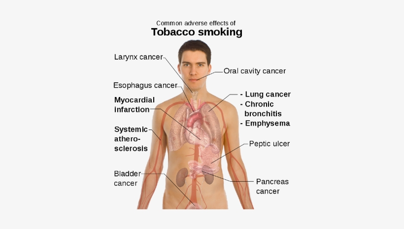 Smoking Effects On The Human Body - Some Effects Of Smoking, transparent png download
