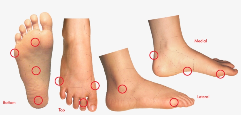 Foot Conditions, transparent png download