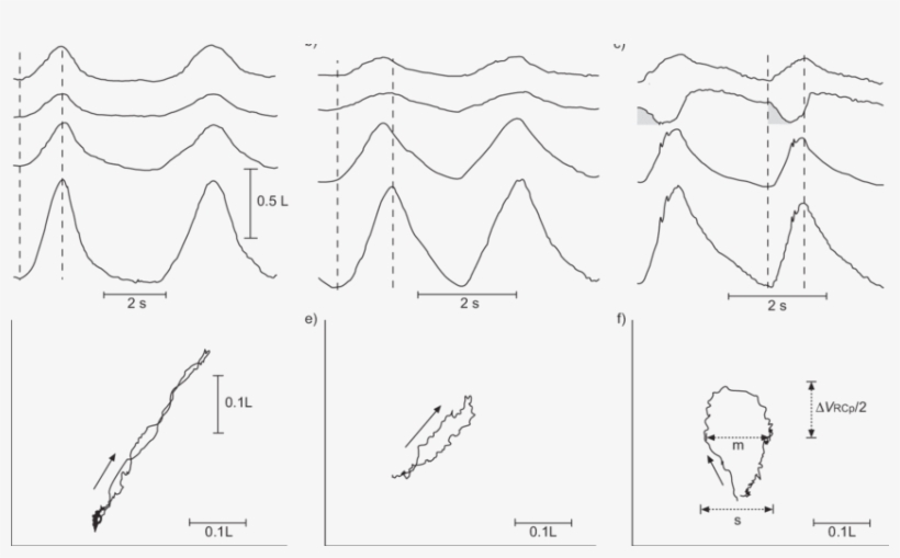 A C) Time Courses Of The Volumes Of The Upper Ribcage,, transparent png download