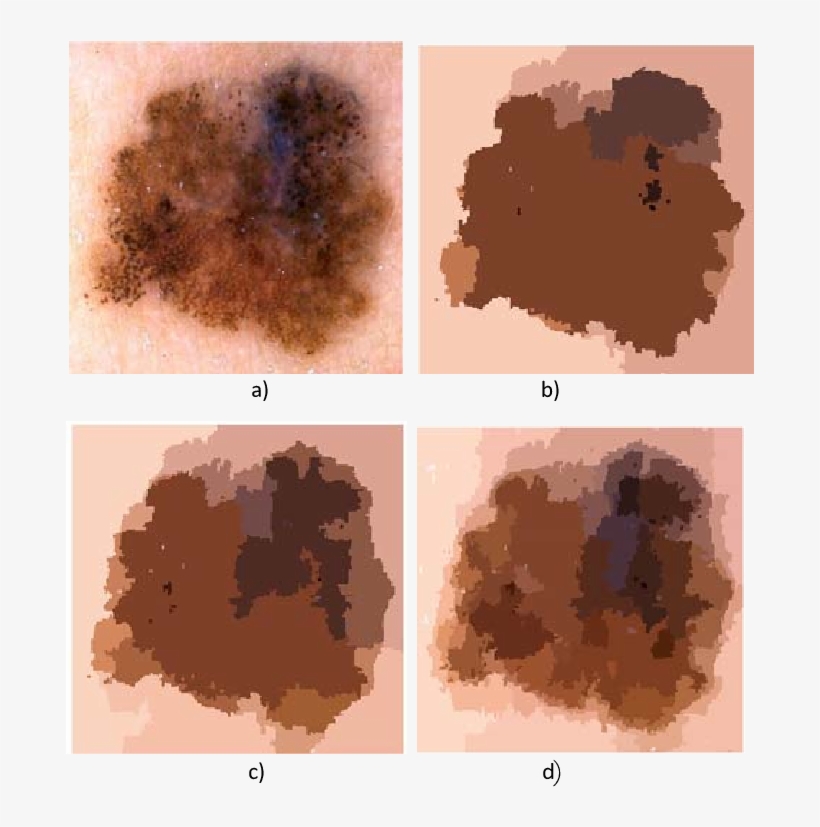 Segmentation Using Statistical Region Merging - Statistical Region Merging, transparent png download