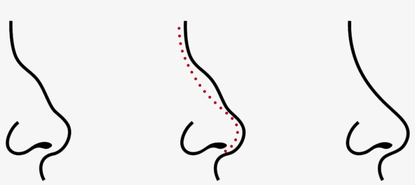 Care Must Be Taken For Several Weeks After Surgery, transparent png download