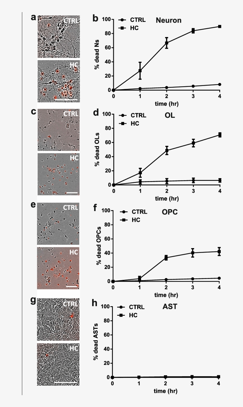 Human Complement Is Toxic To Mouse Neurons And Oligodendrocytes, transparent png download