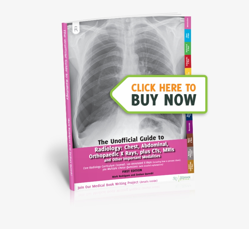 The Unoffical Guide To Radiology, transparent png download