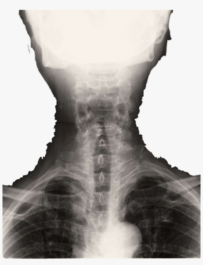 Photodune 3666446 Spinal Column Back Upper Part Xray, transparent png download