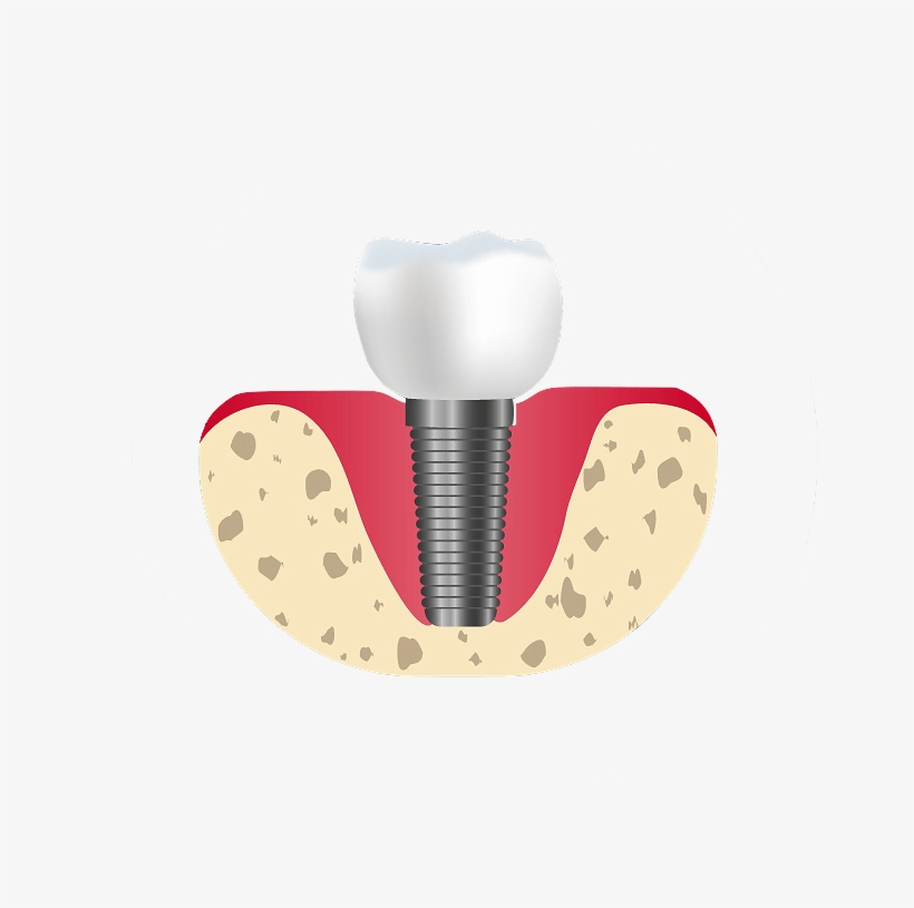 Dental, transparent png download