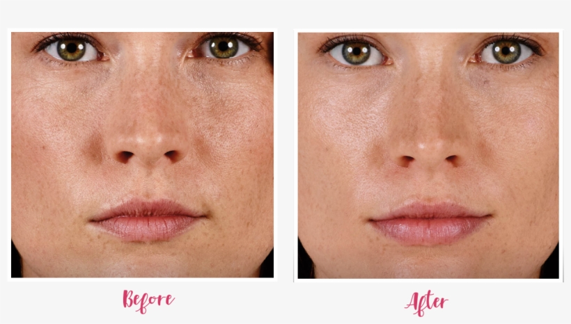 Before And After, transparent png download