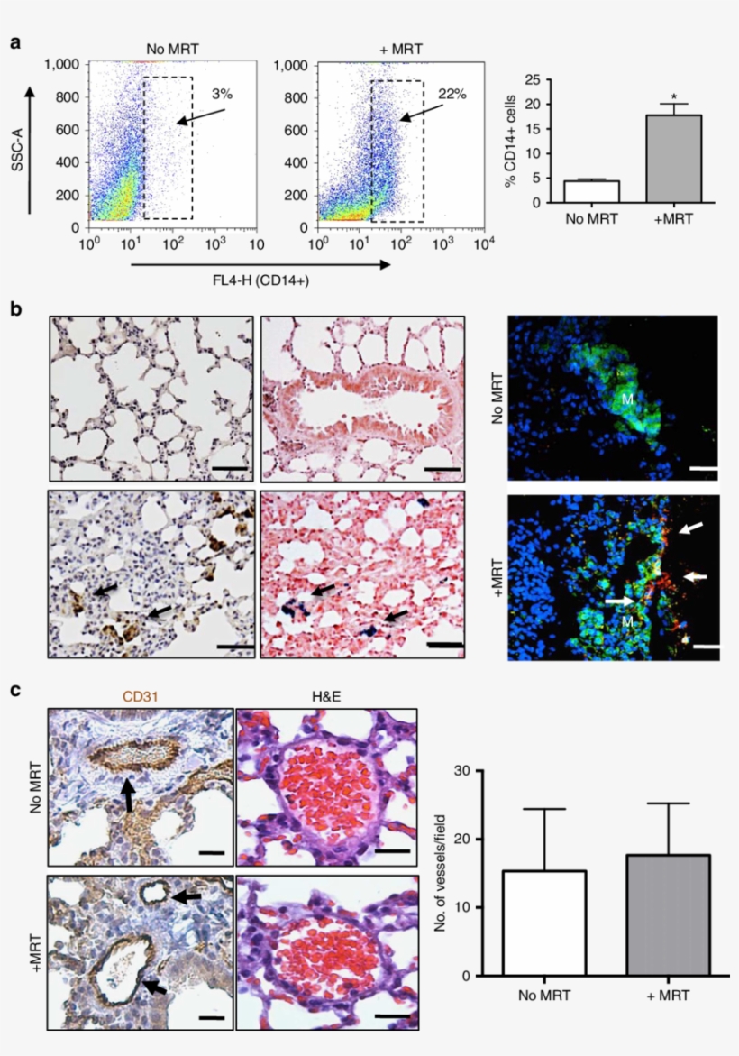 Magnetic Macrophages Were Steered Into Pulmonary Metastasis, transparent png download