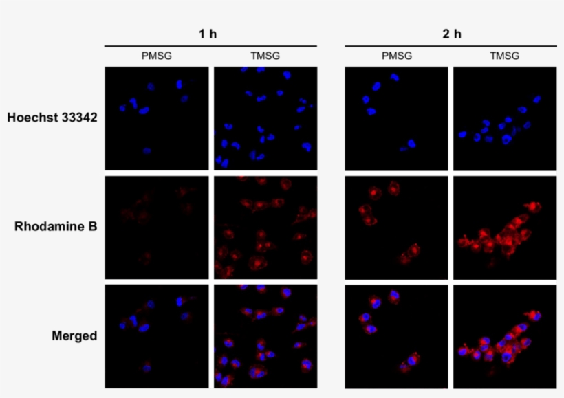 Confocal Laser Scanning Microscope Images Of Mda Mb, transparent png download