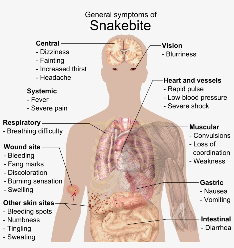 Signs And Symptoms - Do Drugs Affect The Body, transparent png download