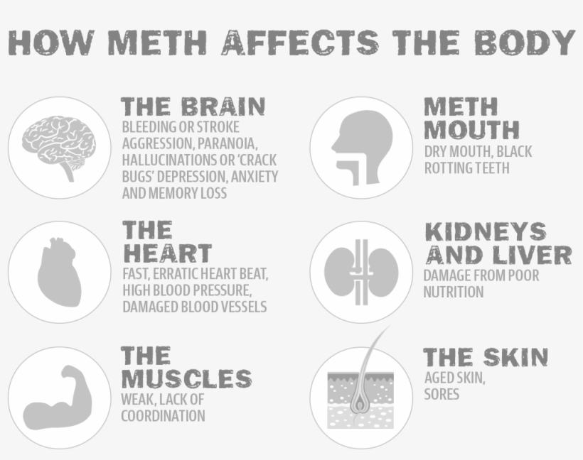 Methonbody - Effects Of Ice On The Brain, transparent png download