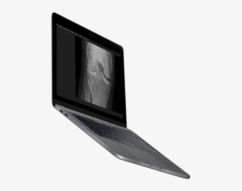 Image Biopsy Lab Software Laptop - Output Device, transparent png download