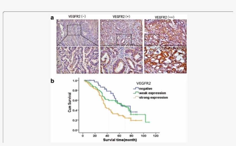 Expressions Of Vegfr2 In Colon Cancer Samles And Kaplan - Map, transparent png download