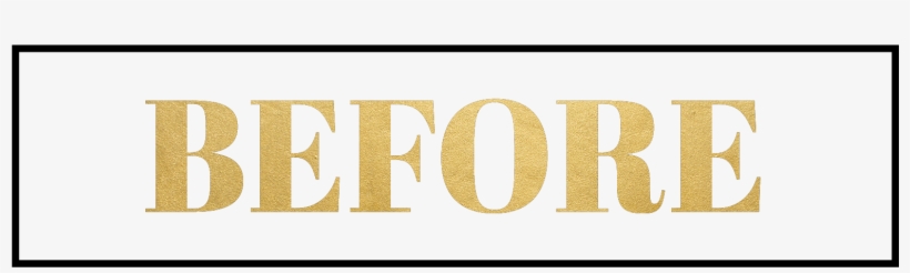 You Should Make Botox Appointments At Least Two Weeks - Beige, transparent png download