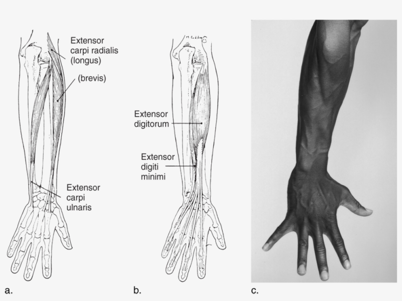 Image Not Available - Medical Radiography, transparent png download