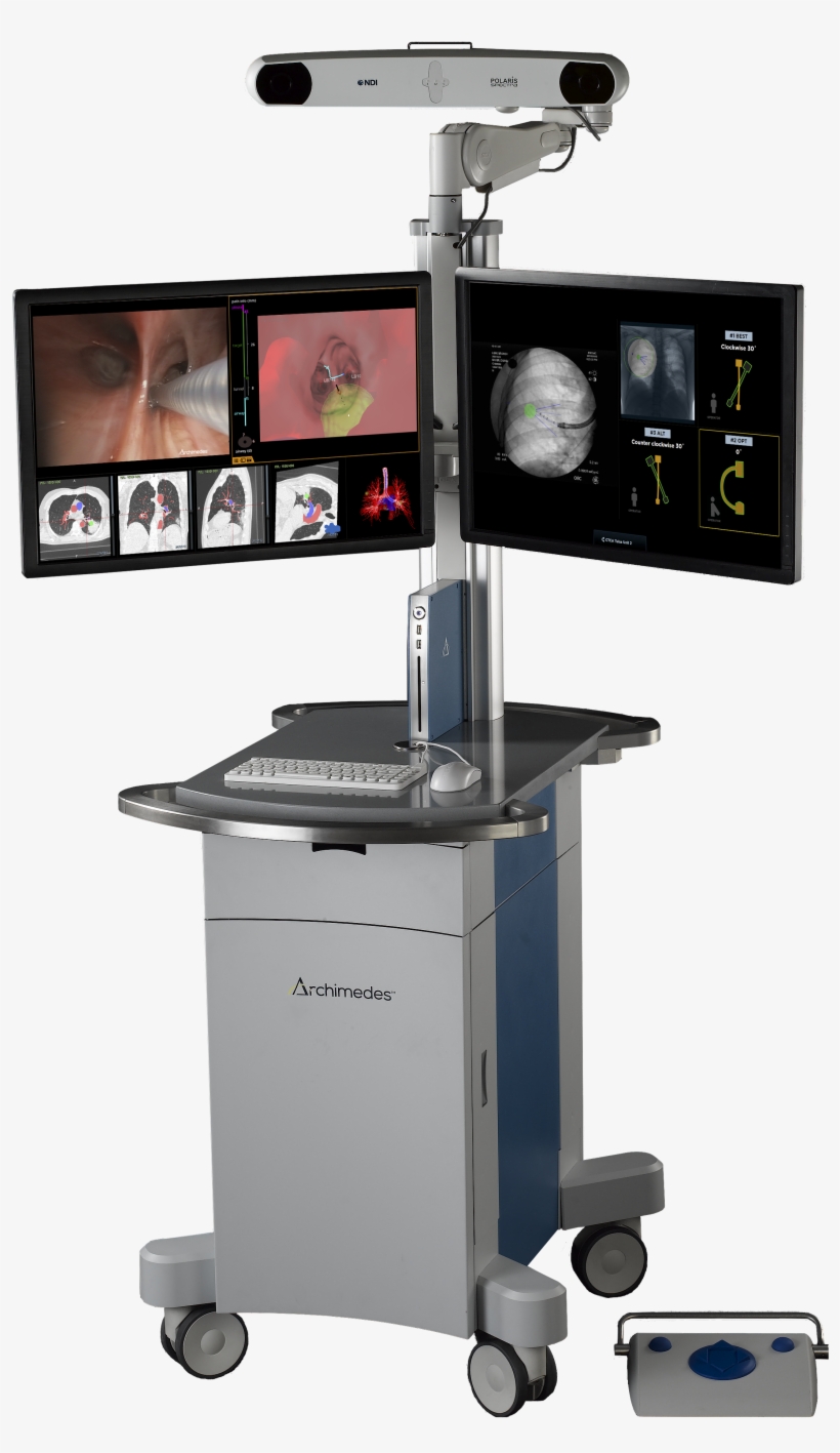 Finding Lung Cancer Outside The Airways Just Got Easier, transparent png download