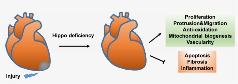 Currently Available Therapies, Such As Drugs And Mechanical, transparent png download