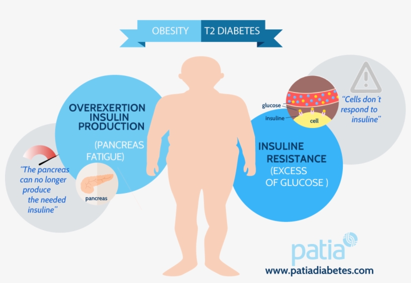 Obesity Type 2 Diabetes - Diabetes Type 2, transparent png download