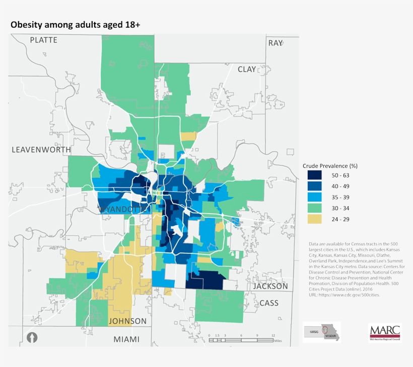 These High Rates Of Obesity And Diabetes Suggest That - Atlas, transparent png download