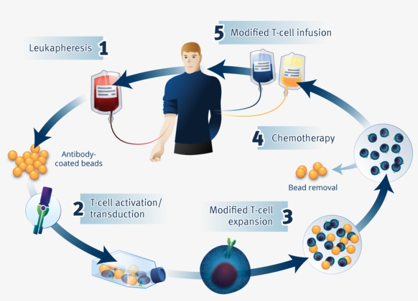 Car T Process - Car T Cell Therapy Process, transparent png download