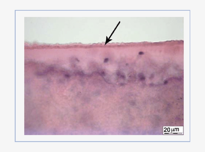Anterior Lens Capsule Following Manual Capsulorhexis - Picture Frame, transparent png download