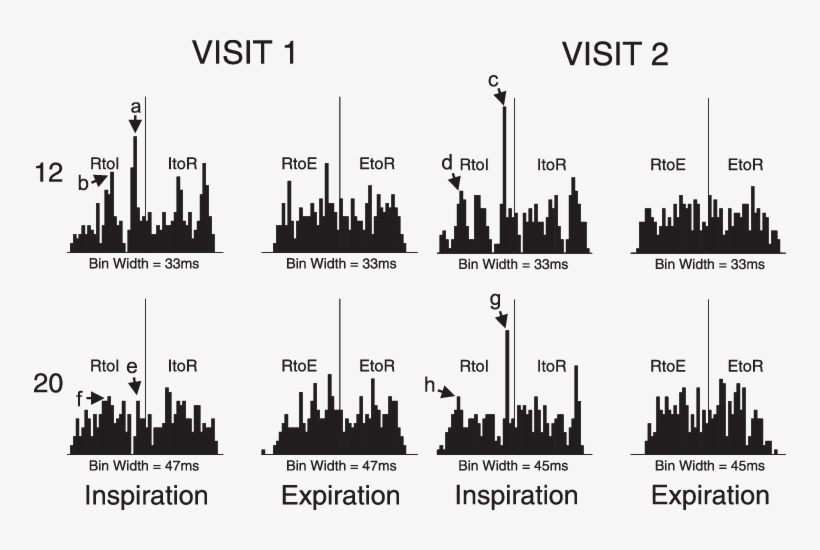 The 27-bin Interval Histograms For 2 Subjects - Metropolitan Area, transparent png download