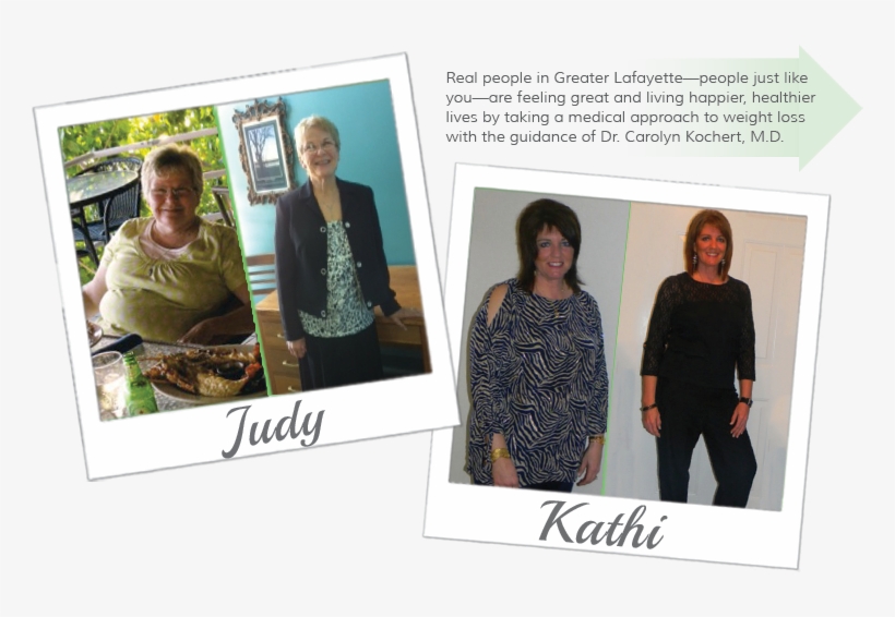 Before And After - Event, transparent png download