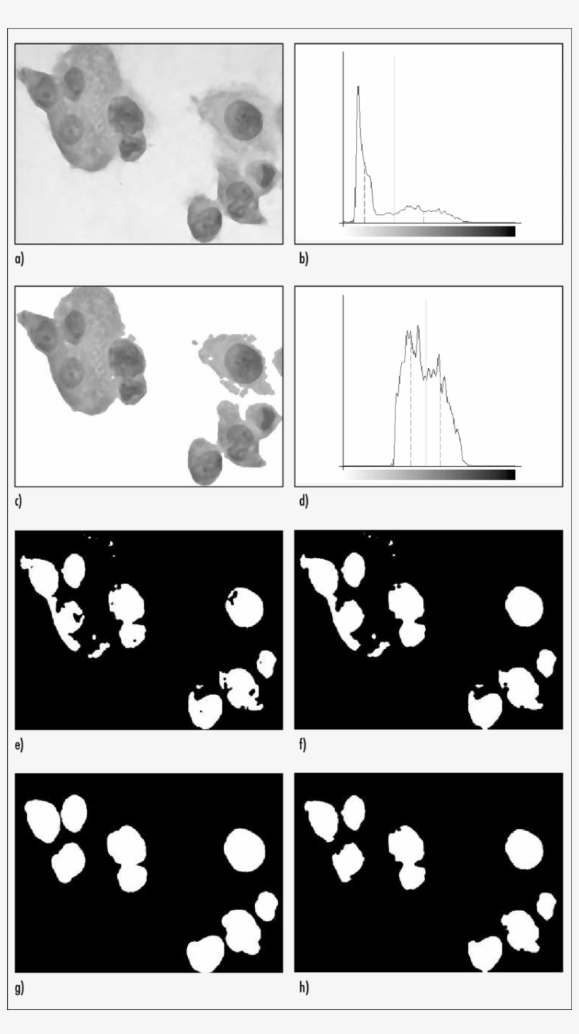 Theseimages Show An Examplefor The Pre-segmentation - Illustration, transparent png download