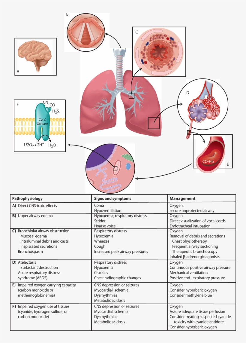 Occupational And Environmental Toxins - Diagram, transparent png download