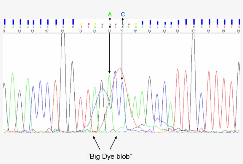 The Blob Can Be At Background Level, Or Override The - Plot, transparent png download