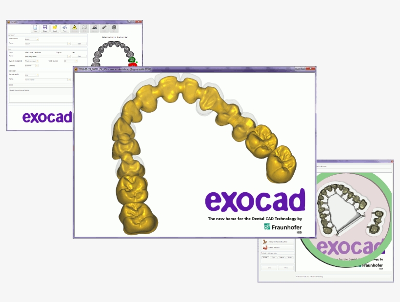 52, 29 August 2010 - Exocad, transparent png download