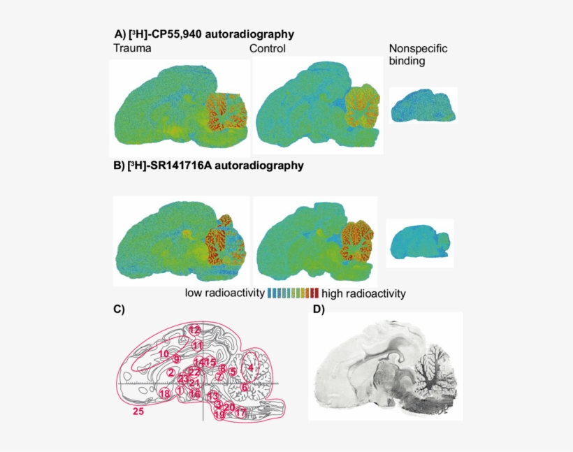 Autoradiographs Of Adjacent Slices Of The Piglet Brain - Diagram, transparent png download