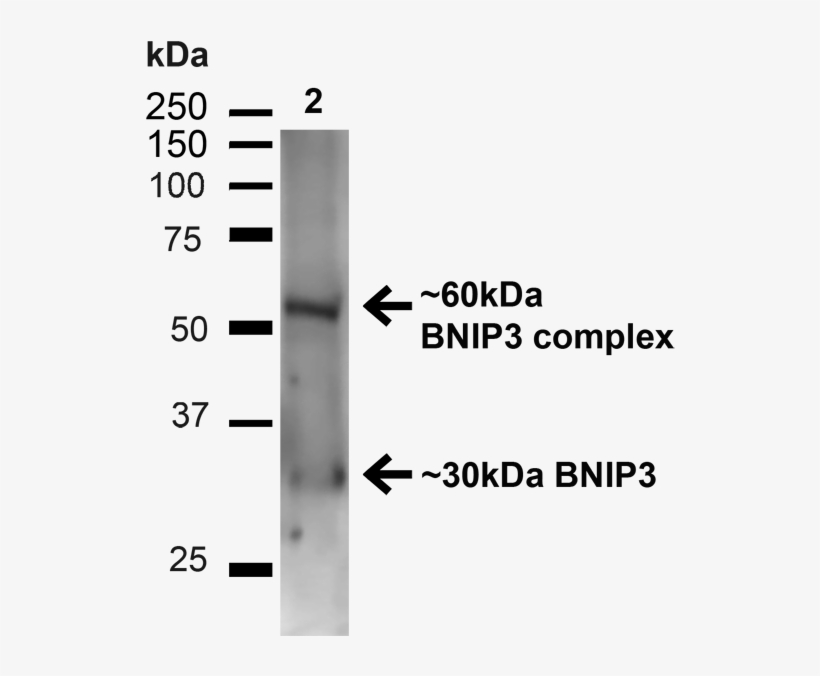 Western Blot - Monochrome, transparent png download