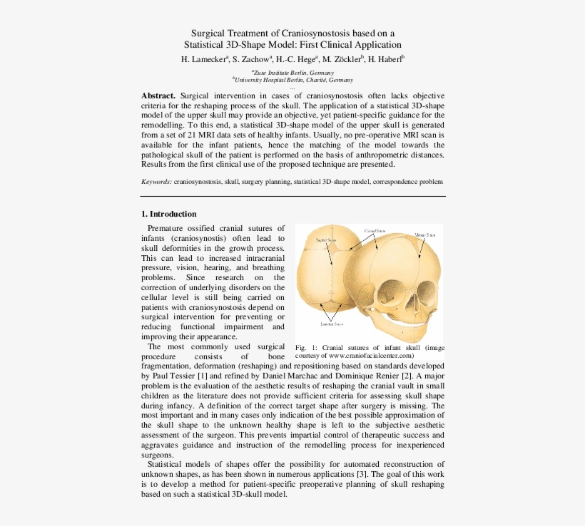 Surgical Treatment Of Craniosynostosis Based On A Statistical - Skull, transparent png download