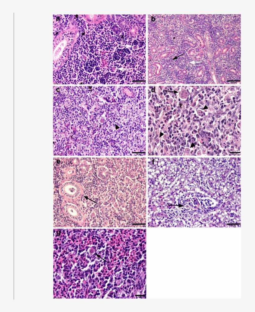 Comparative Histopathology Of Pkd On Rainbow Trout - Pkd Mykiss Histopathology, transparent png download